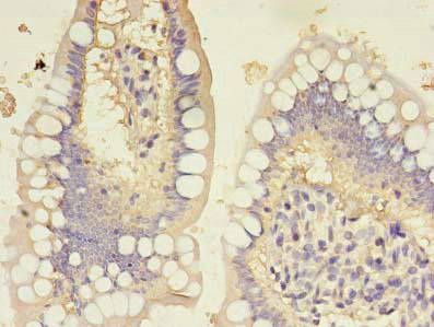 CSB-PA010152LA01HU IHC