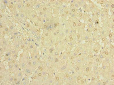 CSB-PA010153LA01HU IHC-2