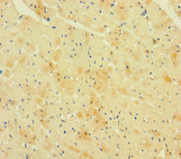 CSB-PA019500LA01HU IHC