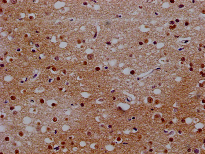 CSB-PA872429ESR1HU IHC-2