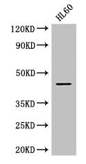 CSB-PA04909A0Rb