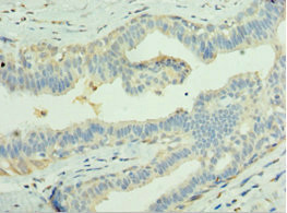 CSB-PA012898ESR2HU IHC