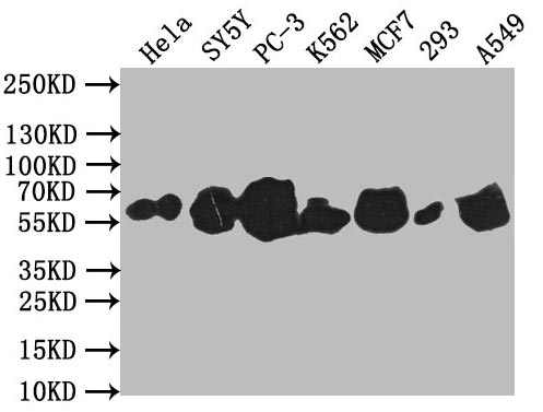 CSB-PA025570LA01HU