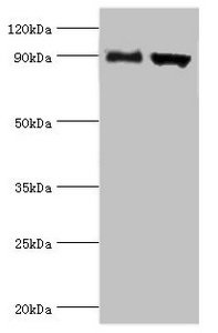 CSB-PA618774ESR1HU