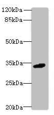 CSB-PA884484LA01HU WB