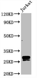 CSB-RA004973A0HU