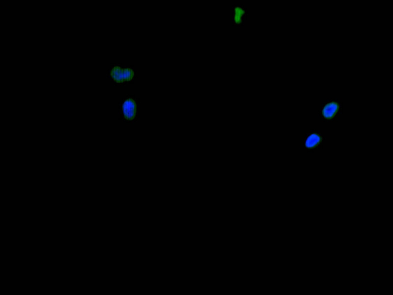 CSB-RA010418MA1HU FC