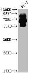 CSB-RA259644A0HU