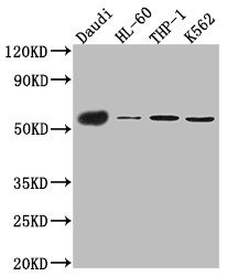 CSB-RA011664MA1HU WB