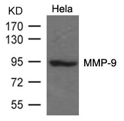 CSB-PA058909