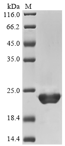 CSB-EP011614HUa0