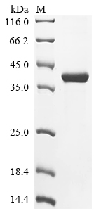 CSB-EP013754HU