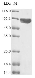 CSB-EP015270HU DS-PAGE