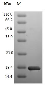 CSB-EP021679HU1 SDS-PAGE