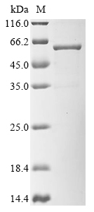 CSB-EP711093HU1-B WB