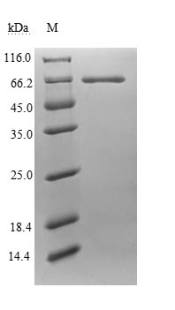 CSB-EP724336HUa0 DS-PAGE