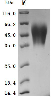 CSB-MP005166HU SDS-PAGE