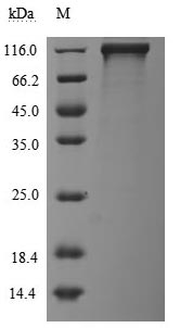 CSB-MP007765HU SDS-PAGE