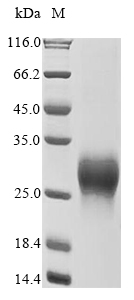 CSB-MP009438HU1 SDS-PAGE