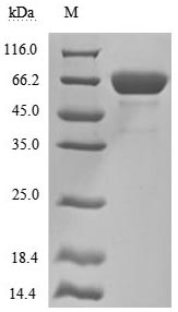 CSB-MP015044HUc9 SDS-PAGE