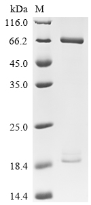 CSB-MP017647HU(M)-B