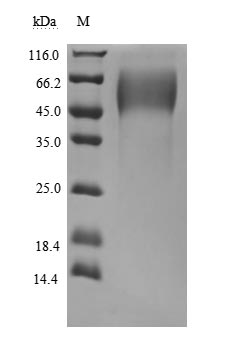 CSB-MP704410HU3c7 SDS-PAGE