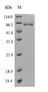 CSB-MP723415HU SDS-PAGE