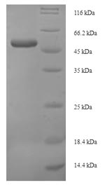 CSB-EP026137HU SDS-PAGE