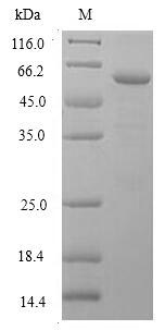 CSB-EP621686HU-SDS