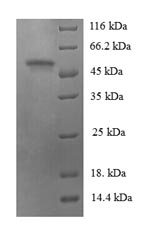 CSB-EP722565HU