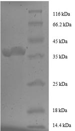 CSB-EP008691HU1