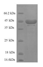 CSB-RP042554h