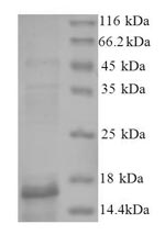 CSB-EP002736HU