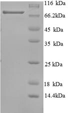 CSB-EP887971HU