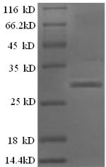 CSB-EP010931HU