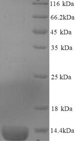 CSB-YP361411MO SDS-PAGE