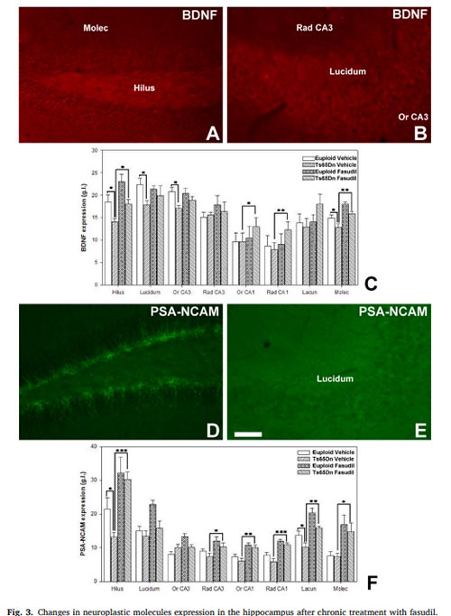 Changes in neuroplastic molecules expression in the hippocampus after chronic treatment with fasudil