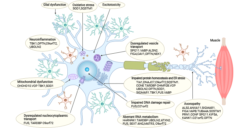 ALS的发病机制