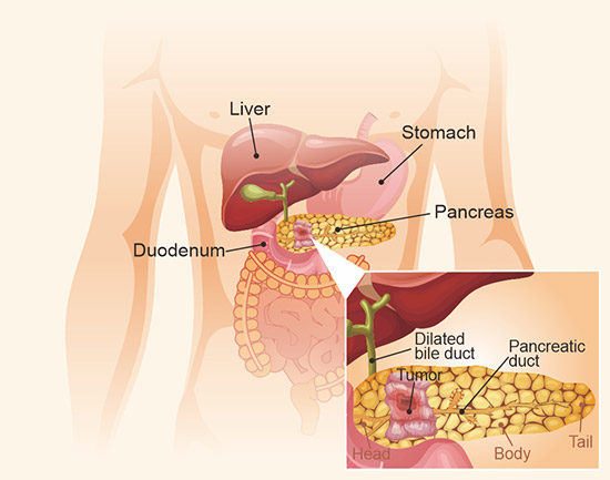 胰腺结构示意图